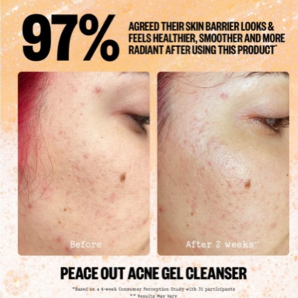 PEACE OUT | Acne Gel Cleanser - Picture 4 of 11
